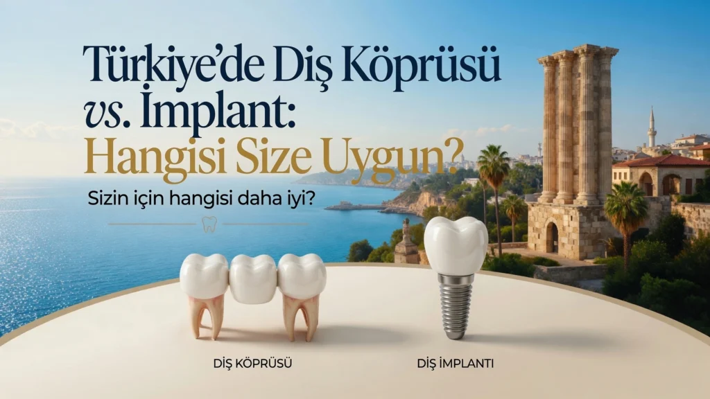 Antalya’da Diş Köprüsü mü İmplant mı: Sizin İçin Doğru Olan Hangisi?