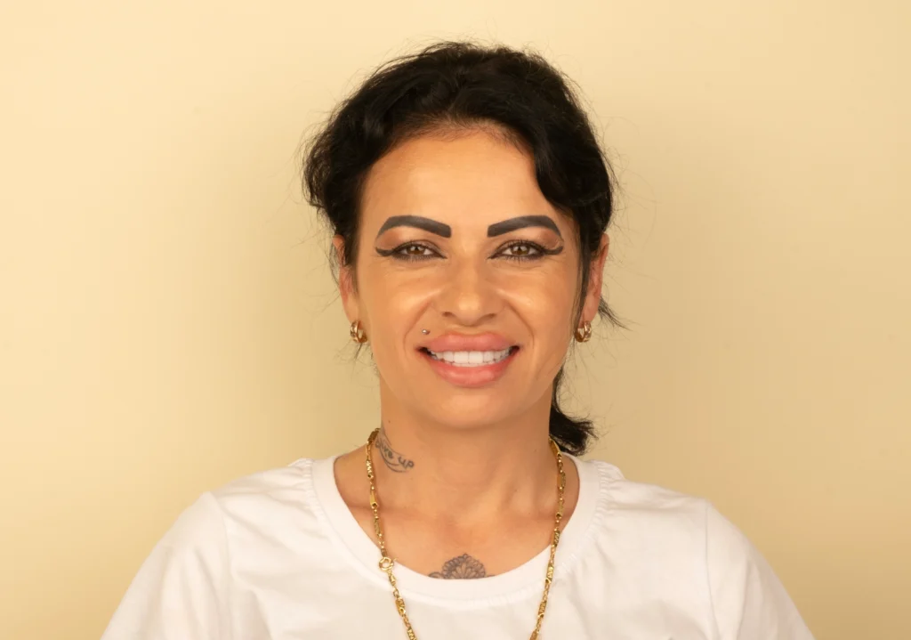 Real smile makeover transformation at DRA Dental Clinic Turkey Title: Real Smile Makeover Transformation