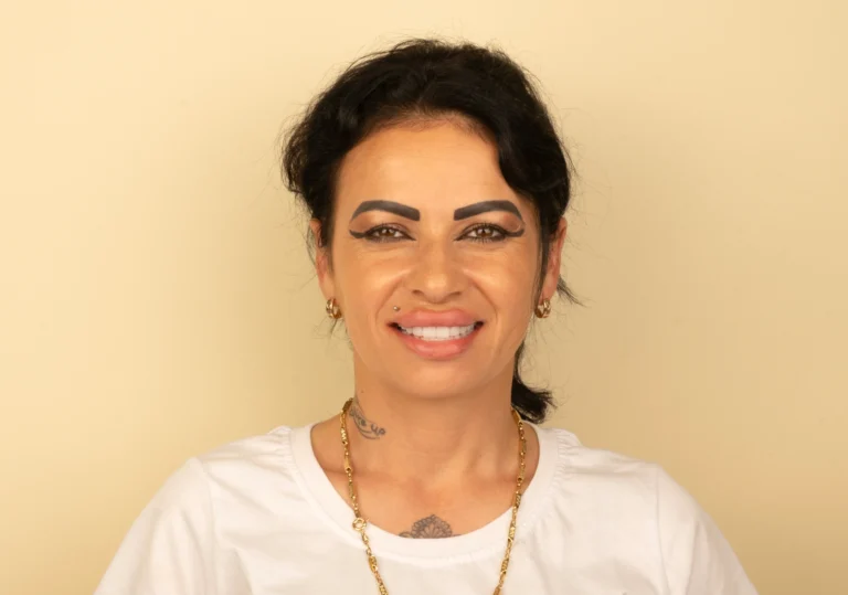 Real smile makeover transformation at DRA Dental Clinic Turkey Title: Real Smile Makeover Transformation