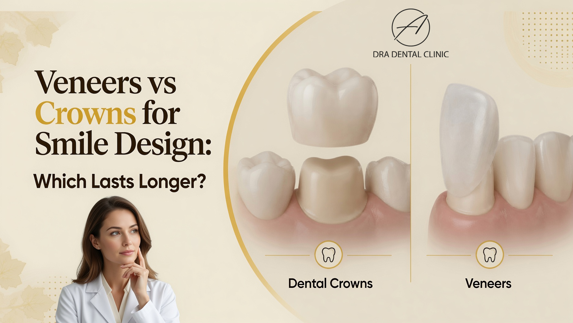 Veneers vs crowns comparison for smile design longevity