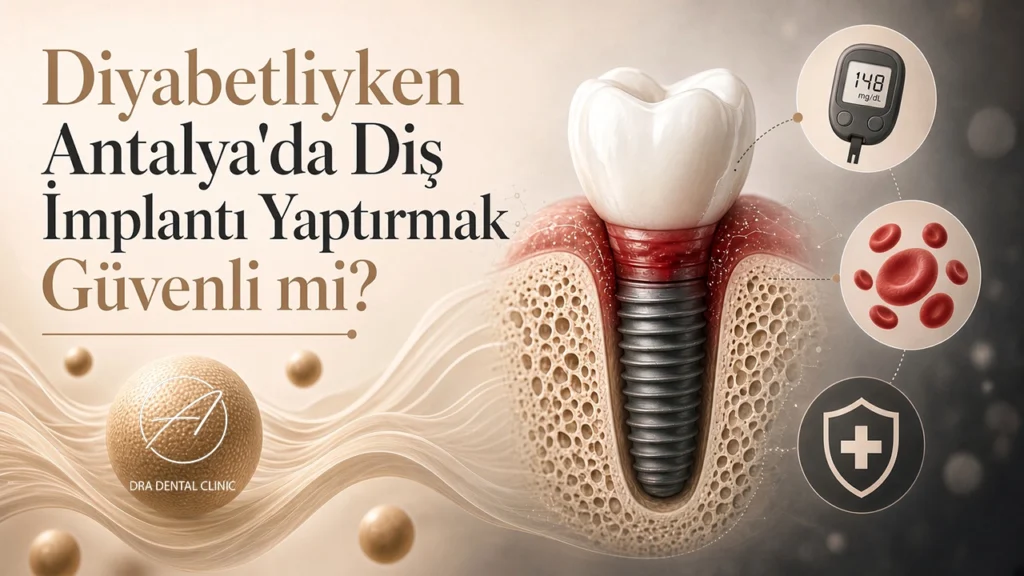 Diyabetliyken Antalya’da Diş İmplantı Yaptırmak Güvenli mi?