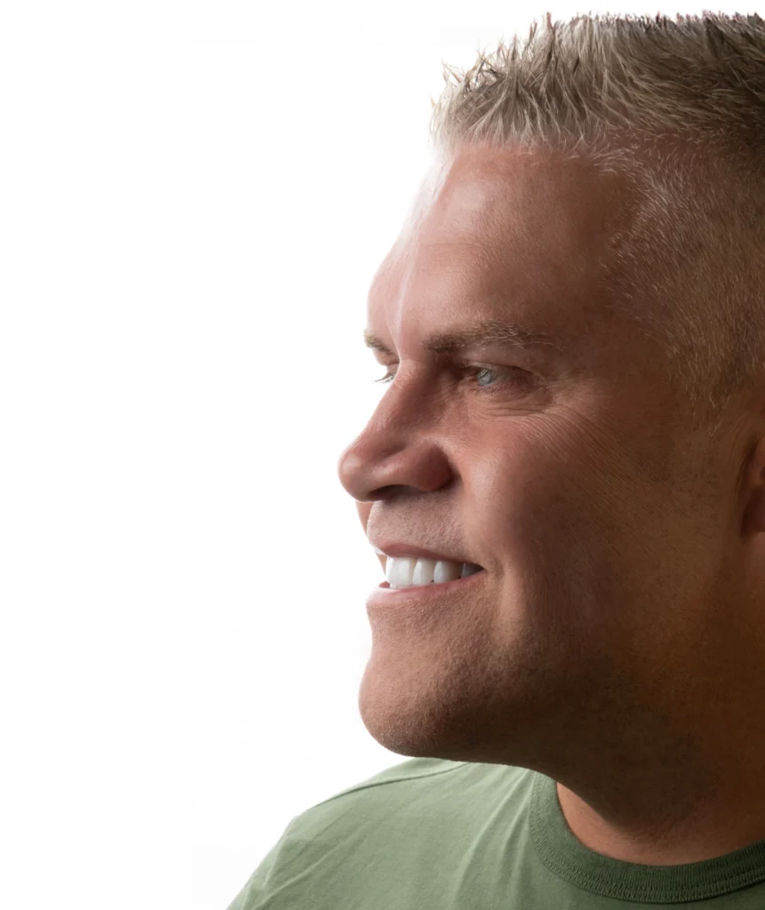 Close-up portrait of a patient smiling after a full smile makeover at a dental clinic in Antalya