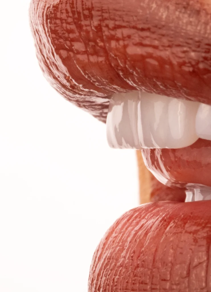 Before and after images of chipped, gapped front teeth corrected through a cosmetic smile transformation