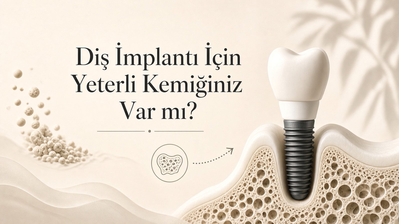 Diş implantı için yeterli kemik olup olmadığını anlatan kapak görseli