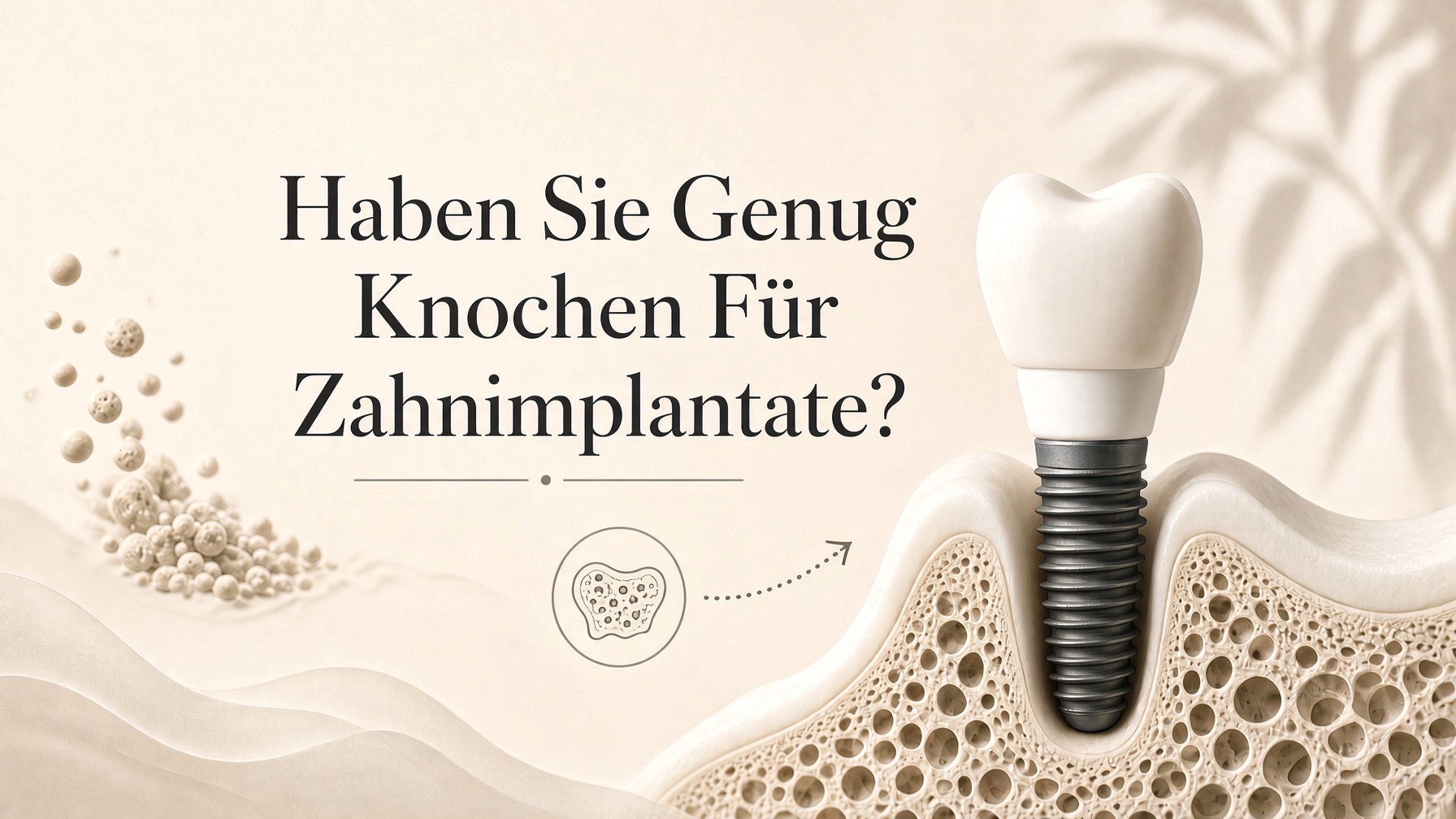 Titelbild dazu, ob genug Knochen für Zahnimplantate vorhanden ist